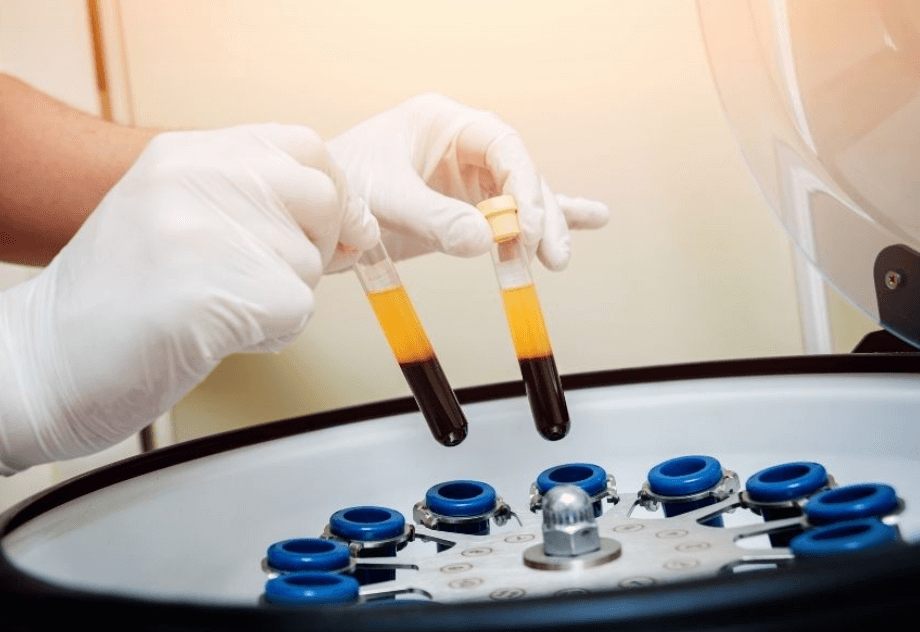 PRP: Regeneración real para la disfunción&nbsp;eréctil